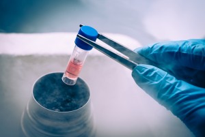 Применение стволовых клеток для лечения наследственных недугов и онкологии