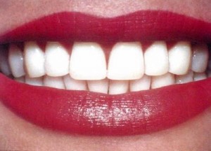 Способы получения «новых» зубов