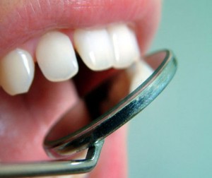 Отбеливание зубов. Противопоказания