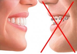 Ровные зубы без брекетов