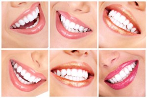 Как отбеливают Ваши зубки?