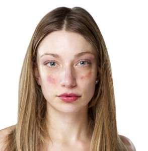 Аллергическая кожа: характеристики и уход 