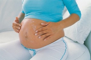 Когда появляются растяжки при беременности