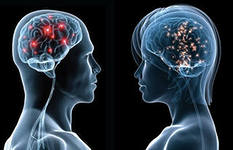 Мозг мужчины и женщины.